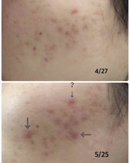 キールズ ハーバル トナー CL アルコールフリー/Kiehl's/化粧水を使ったクチコミ(2枚目)