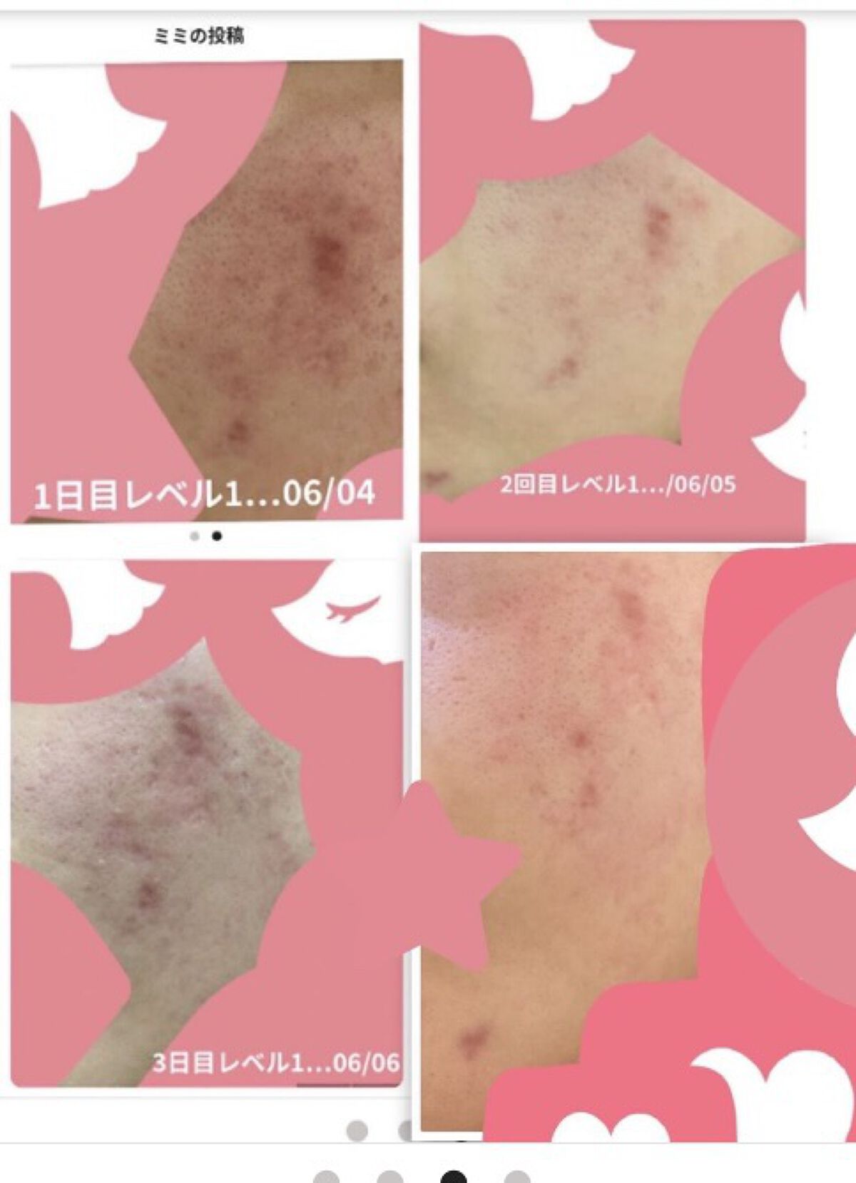 もち肌コラーゲンセラム3.0/MEDICUBE/美容液を使ったクチコミ（3枚目）