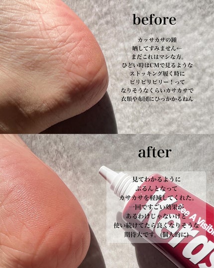 ケラサル ネイル爪栄養剤/Kerasal/ネイルオイル・トリートメントを使ったクチコミ(4枚目)