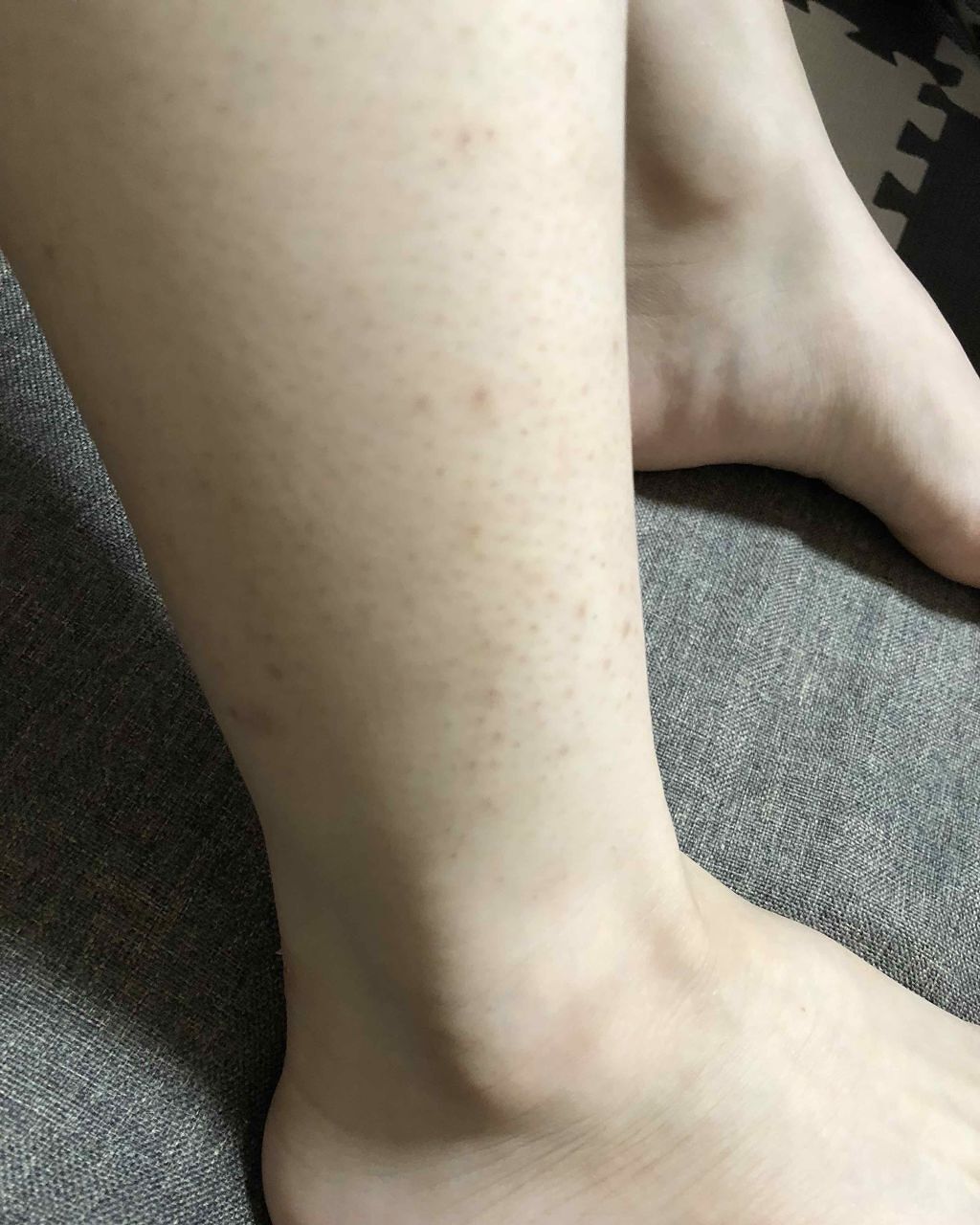 ケアノキュア（医薬品）/小林製薬/その他を使ったクチコミ（3枚目）