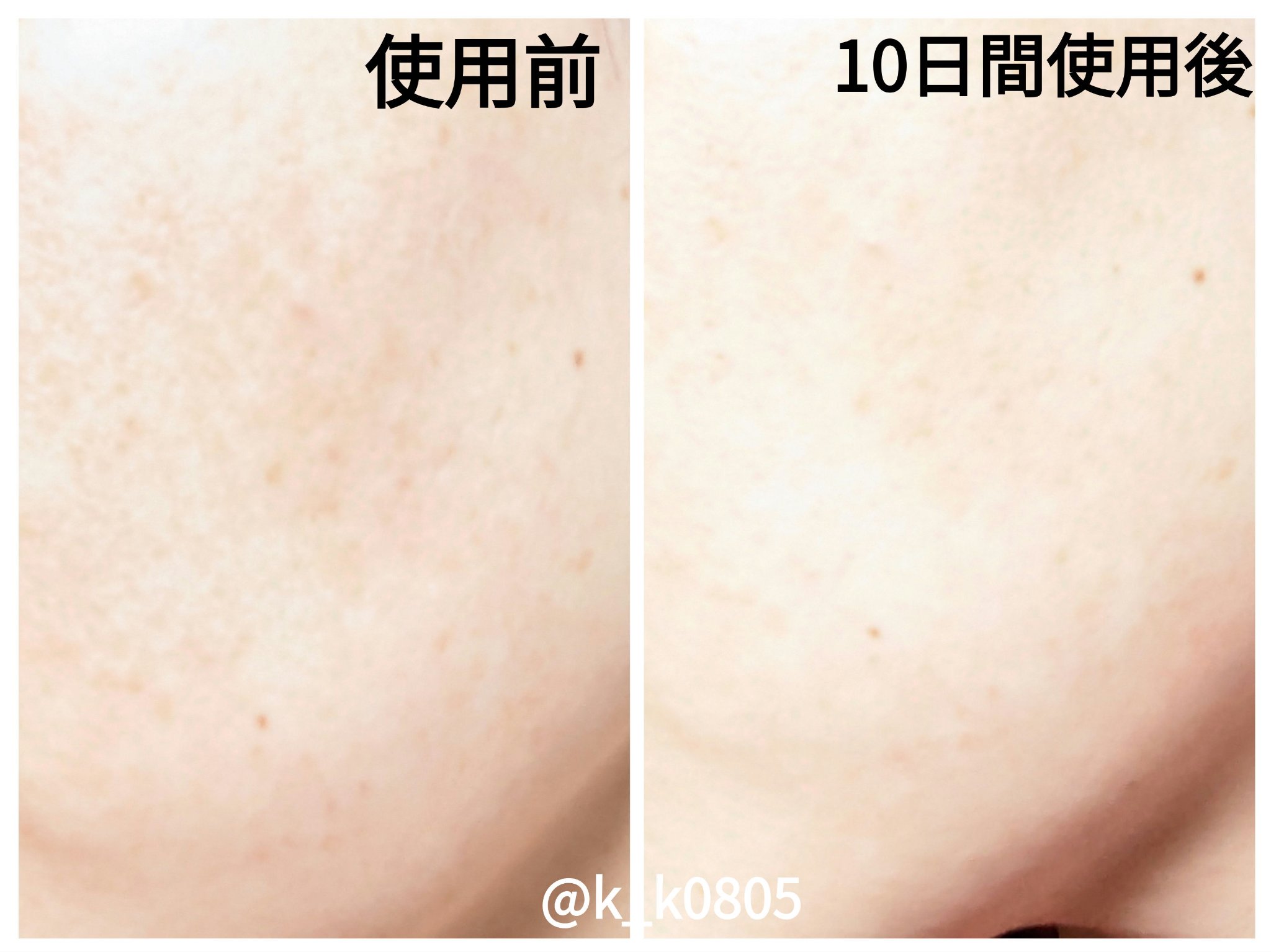 S300 リードル/VT/美容液を使ったクチコミ（2枚目）