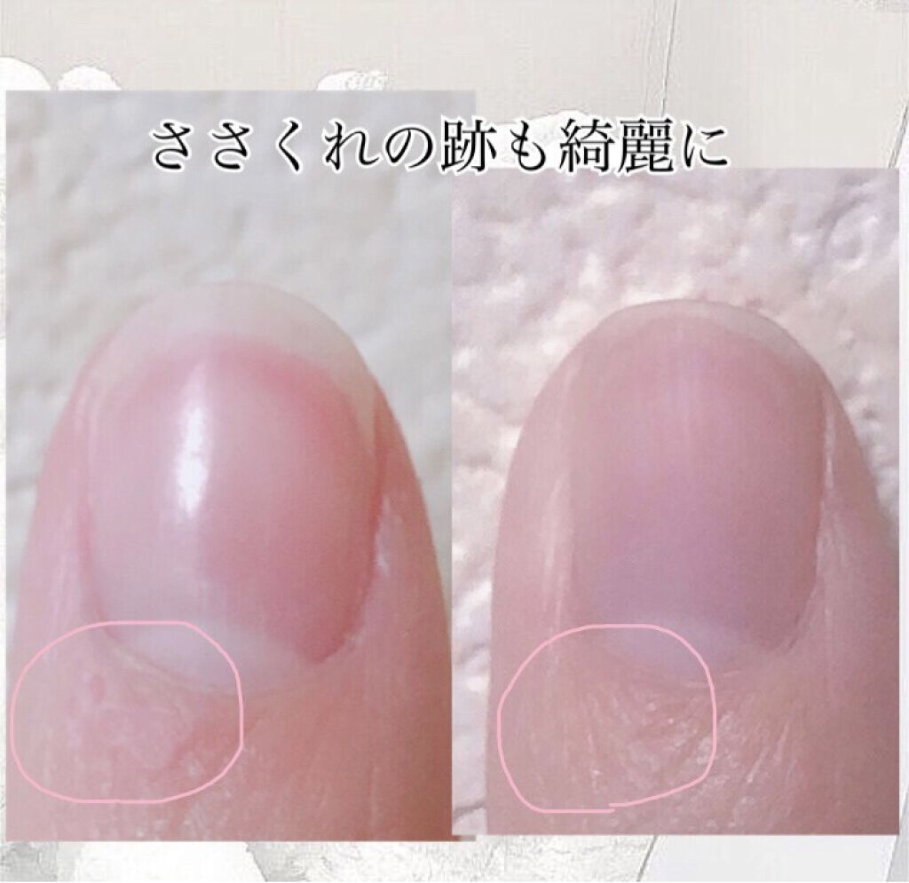 ウィンマックス キューティクルオイル/DAISO/ネイルオイル・トリートメントを使ったクチコミ（3枚目）