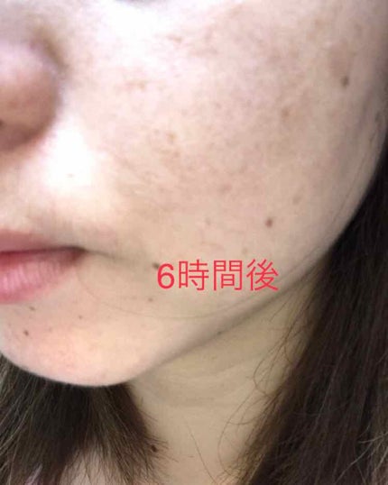 ビヨンド パーフェクティング ファンデーション 19/CLINIQUE/リキッドファンデーションを使ったクチコミ(3枚目)