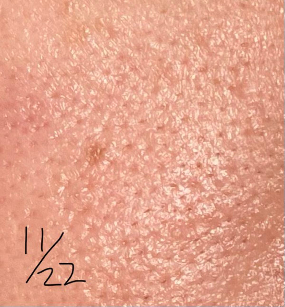 ガラクナイアシン2.0エッセンス/manyo/美容液を使ったクチコミ(5枚目)