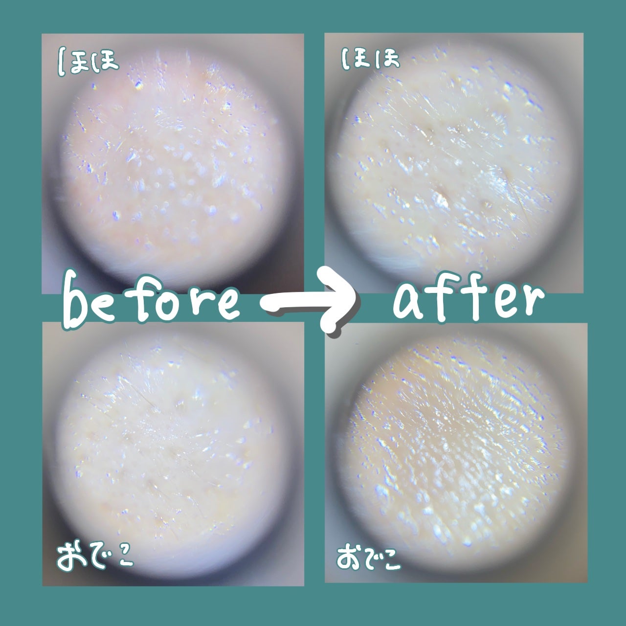 すもも on LIPS 「話題のリードルショット試してみたー!!わたし鈍感だけど1回の使..」(2枚目)