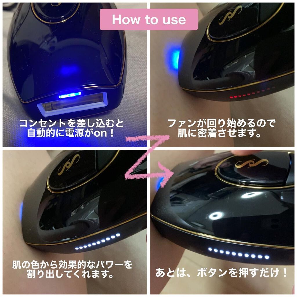 スムーズスキン pure fit/スムーズスキン/家庭用脱毛器を使ったクチコミ（3枚目）