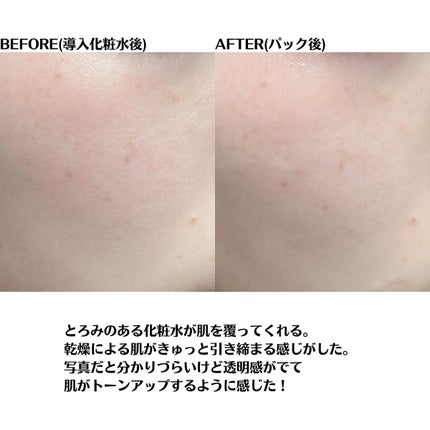 クリアエッセンスマスク/ピュレア/シートマスク・パックを使ったクチコミ(6枚目)