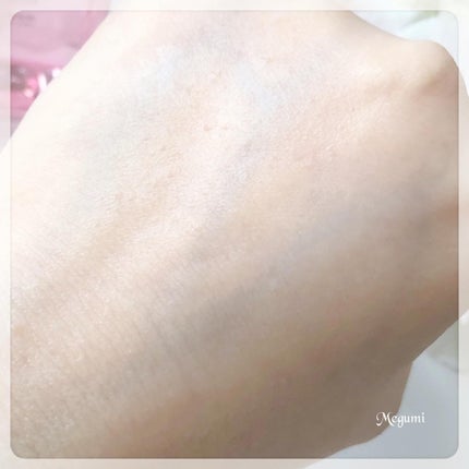 ピンクティーツリートナー/APLIN/化粧水を使ったクチコミ(6枚目)