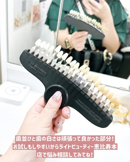 ちっちみ on LIPS 「🦷ホワイトニング結構頑張ってたんだけど、忙しくしておサボりして..」(7枚目)