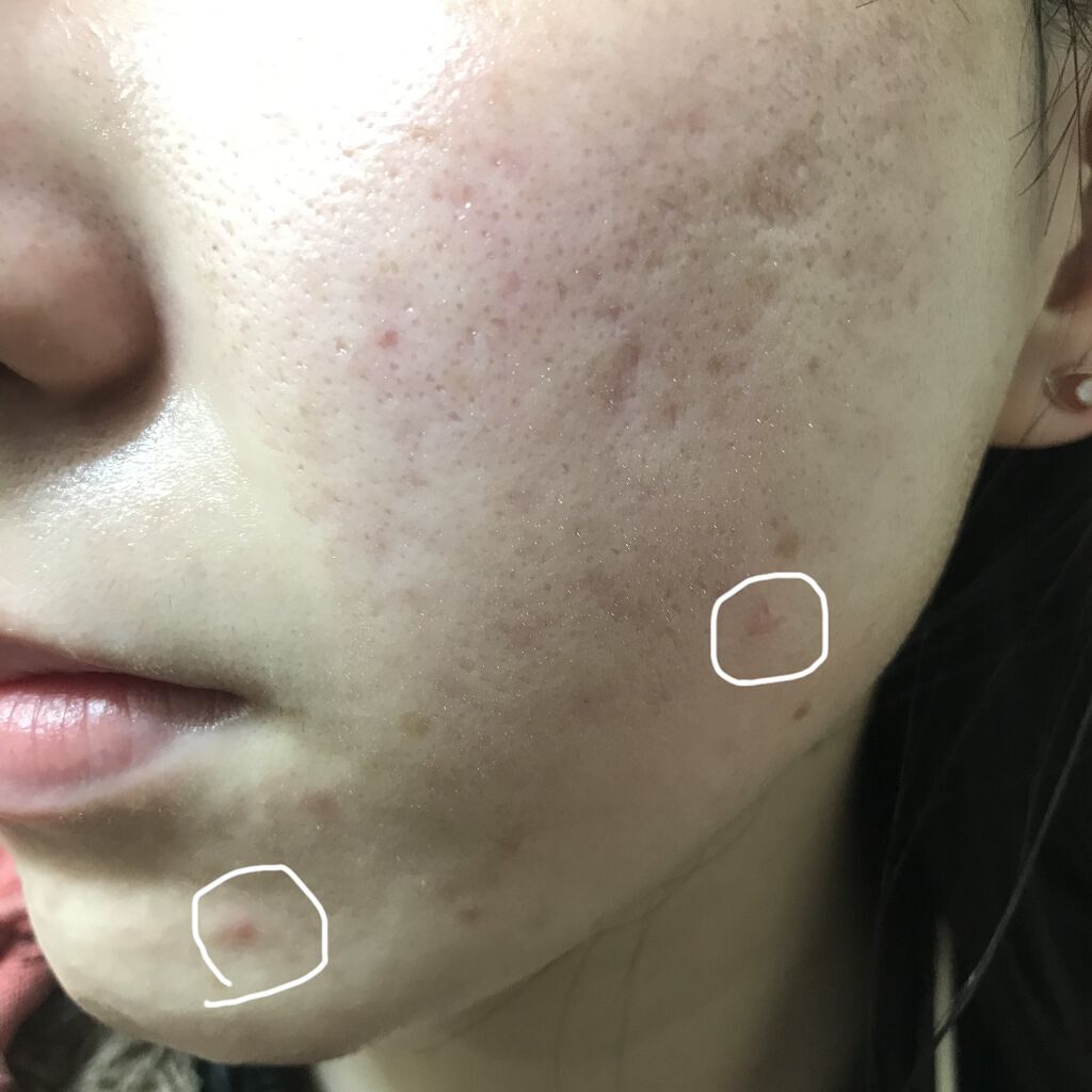 シルコット うるうるコットン/シルコット/コットンを使ったクチコミ（3枚目）