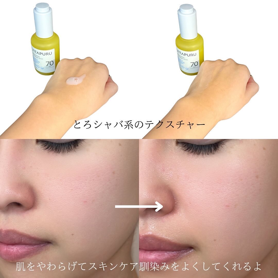 ビタプル ディープリペア セラム/VITAPURU/美容液を使ったクチコミ（3枚目）