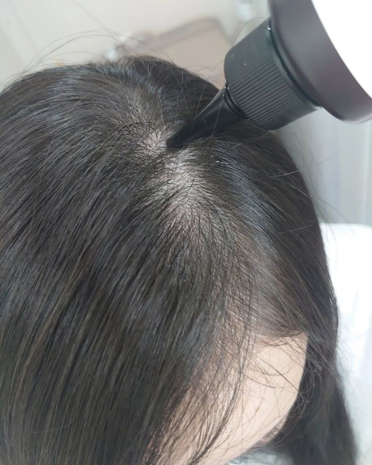 ナノグロウリッチ/iqumore/頭皮ローションを使ったクチコミ（3枚目）