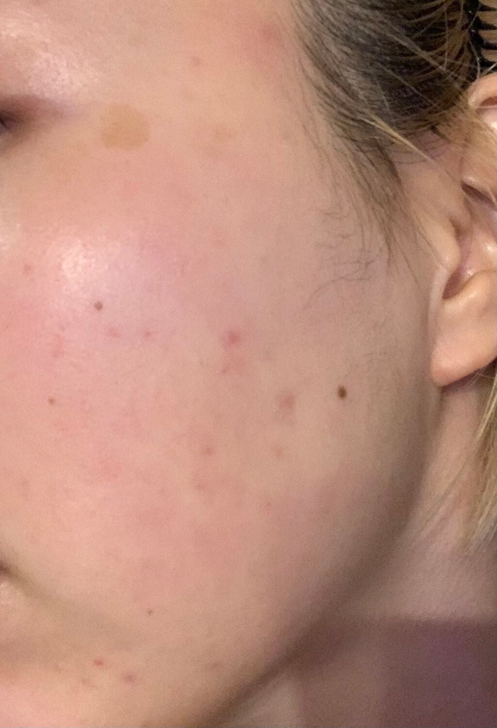 デュオ ザ クレンジングバーム クリア/DUO/クレンジングバームを使ったクチコミ(2枚目)