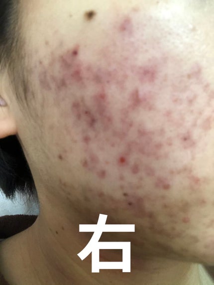 を使ったクチコミ(2枚目)