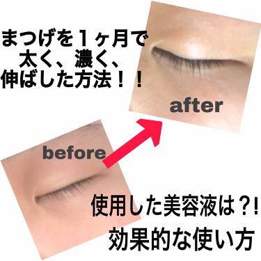 リップ オリジナル ヴァセリンを使った口コミ 私のまつ毛はとにかく少なくて抜けやすいまつ By あいか 脂性肌 10代前半 Lips