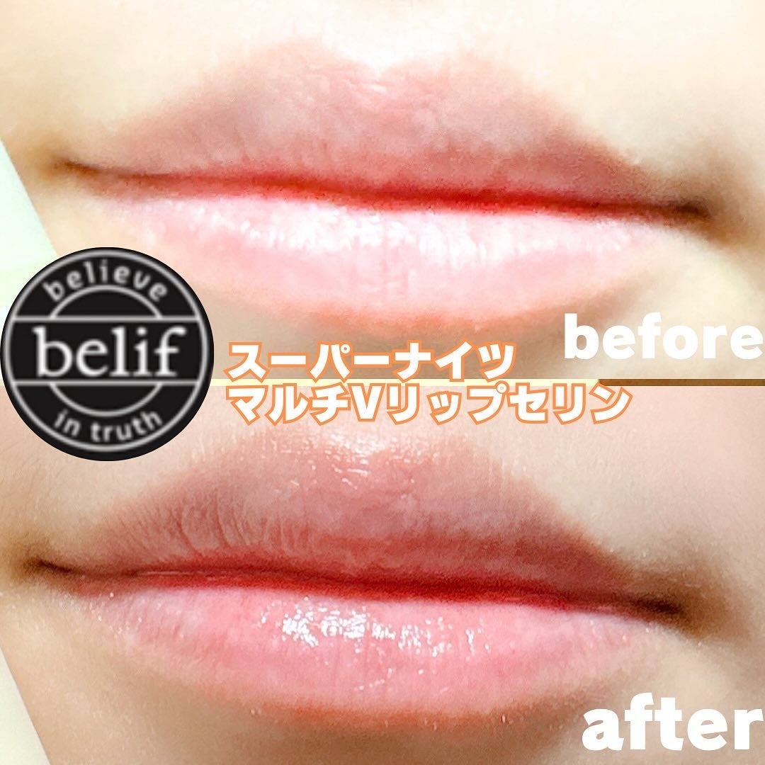 スーパーナイツ マルチ V リップセリン /belif/リップクリームを使ったクチコミ(5枚目)