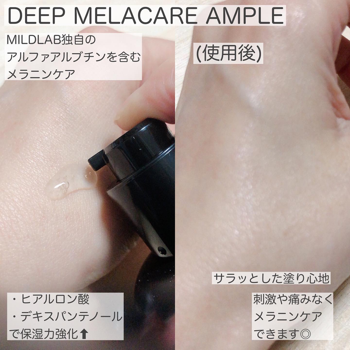 ディープ メラケア 美容液/Mildlab/美容液を使ったクチコミ（2枚目）