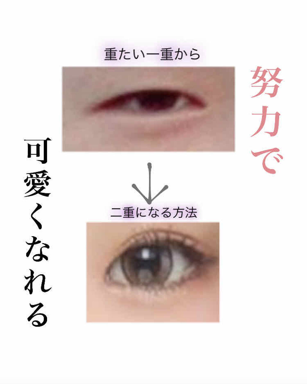 アイトーク/アイトーク/二重まぶた用アイテムを使ったクチコミ（1枚目）