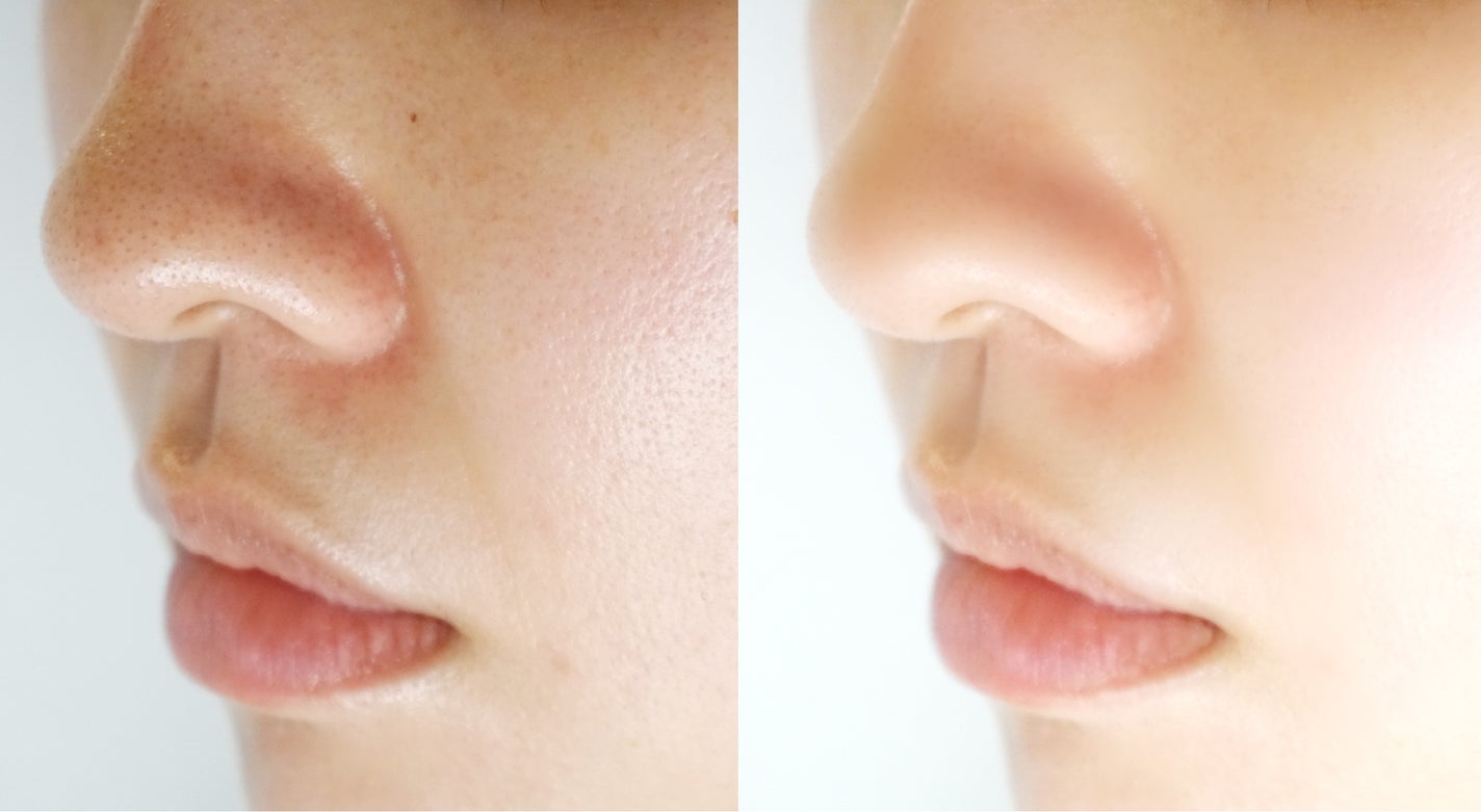 薬機法や医薬品等適正広告基準って何?|みんなを守るために気をつけてほしいことの画像