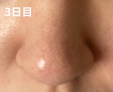 ホホバオイル/無印良品/ボディオイルを使ったクチコミ(5枚目)