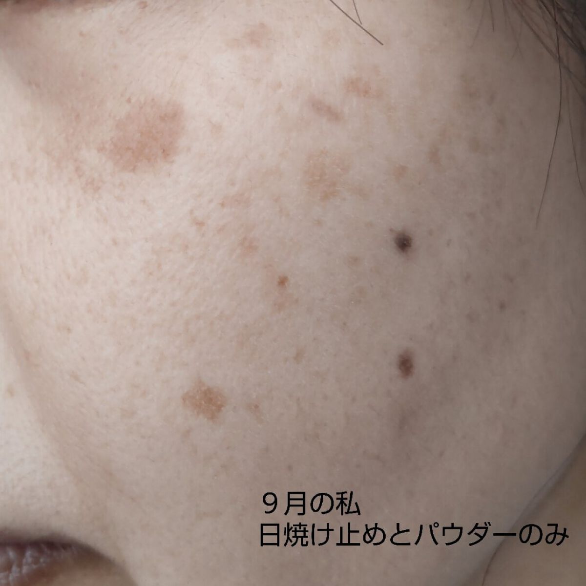 シナールエクシア　ホワイトメディカルエッセンス/シオノギ製薬/美容液を使ったクチコミ（3枚目）