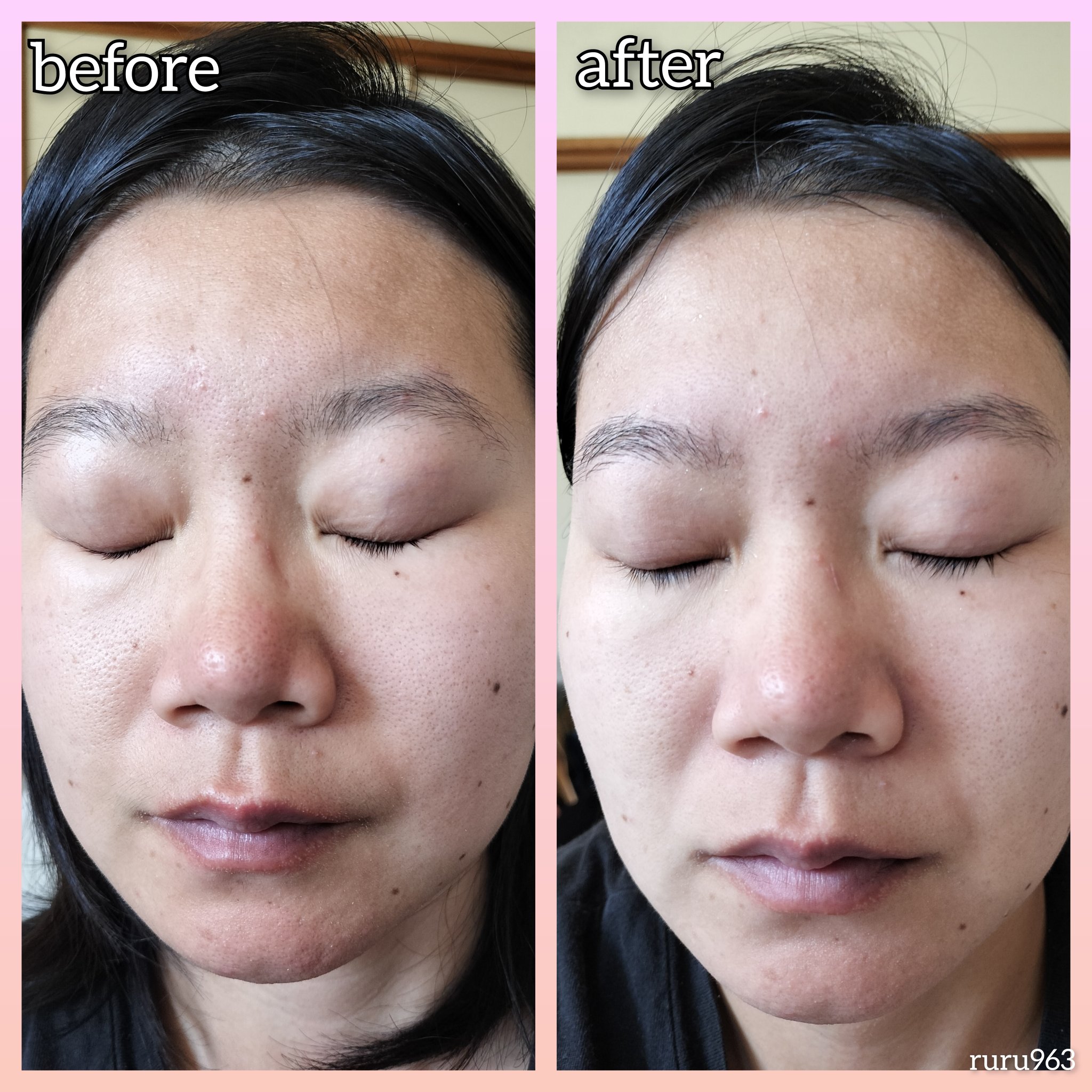 ピンクティーツリーライスシカウォッシュオフパック/APLIN/洗い流すパック・マスクを使ったクチコミ（3枚目）