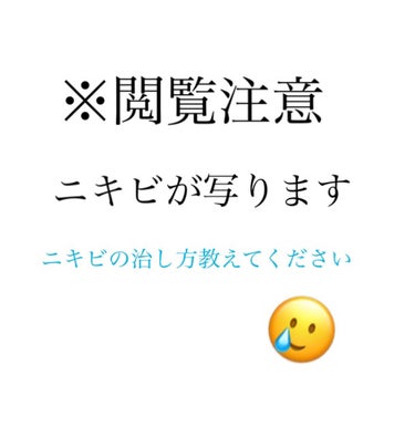 ニキビ治療薬(医薬品)/メンソレータム アクネス/その他を使ったクチコミ（1枚目）