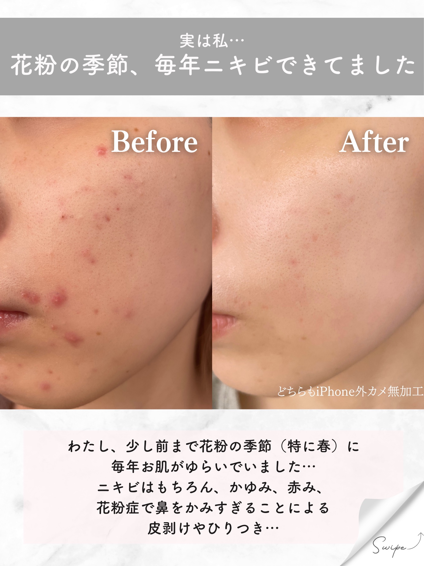 シカプラスト リペアクリーム B5+	/ラ ロッシュ ポゼ/フェイスクリームを使ったクチコミ（2枚目）