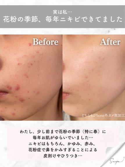 フェルゼアプレミアム 薬用泡の化粧水/フェルゼア/化粧水を使ったクチコミ(2枚目)