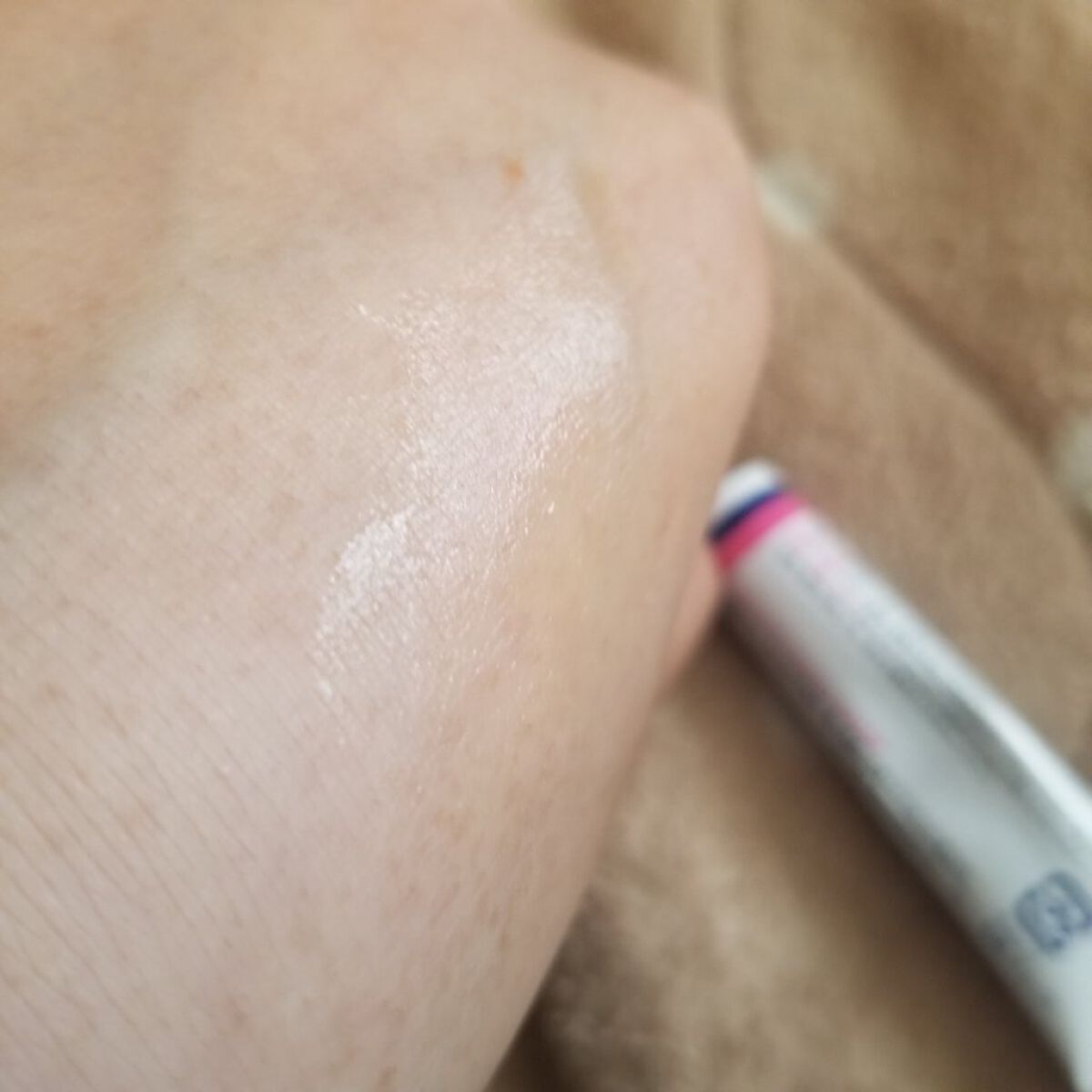 テラ・コートリル 軟膏(医薬品)/ジョンソン・エンド・ジョンソン/その他を使ったクチコミ(4枚目)