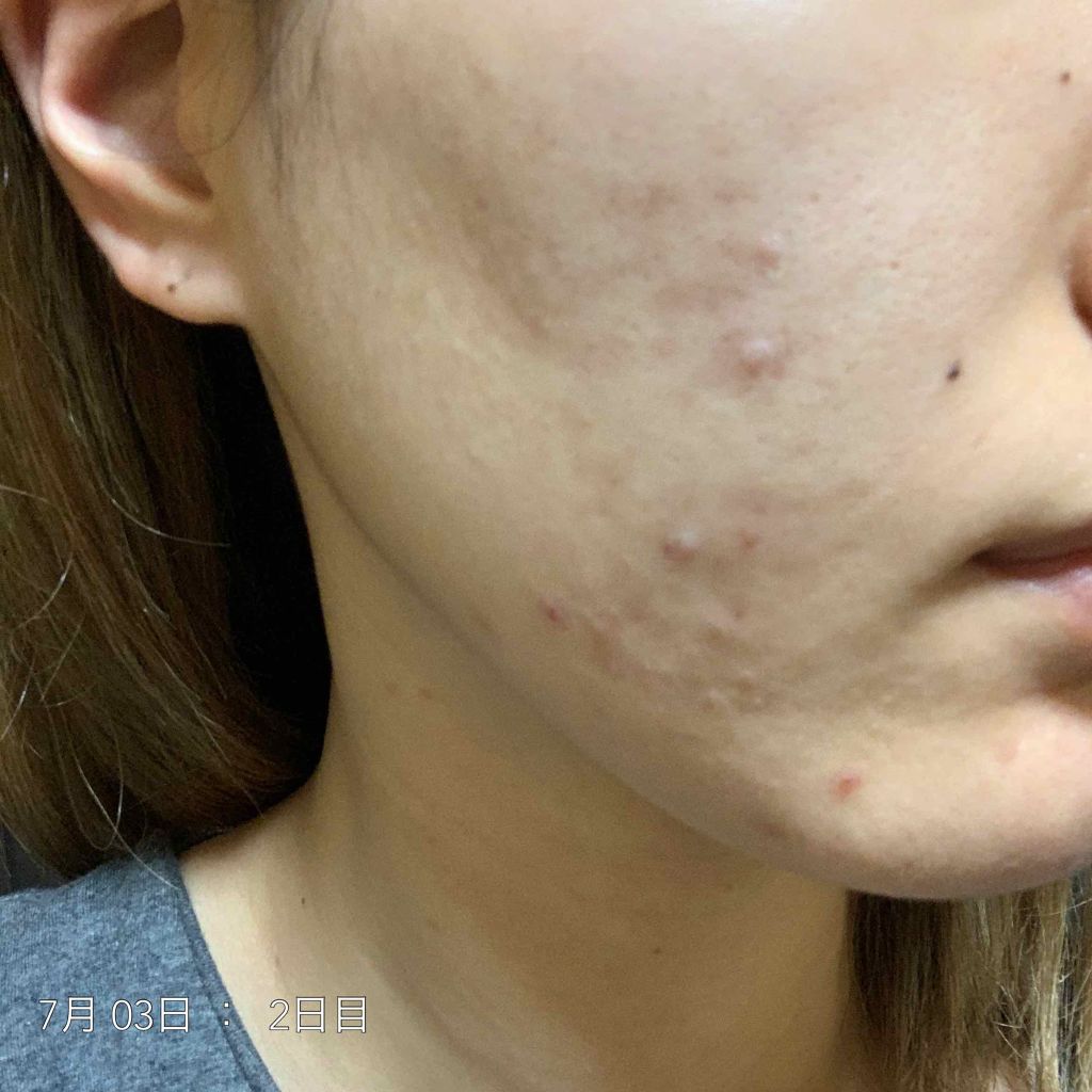 ハトムギ保湿ジェル(ナチュリエ スキンコンディショニングジェル)/ナチュリエ/美容液を使ったクチコミ（2枚目）