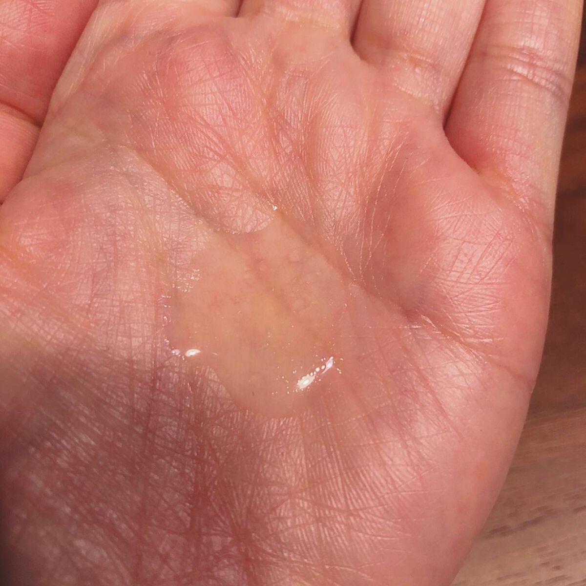 ステムトリートメント デュアルリペアセラム/Reinca/美容液を使ったクチコミ(6枚目)