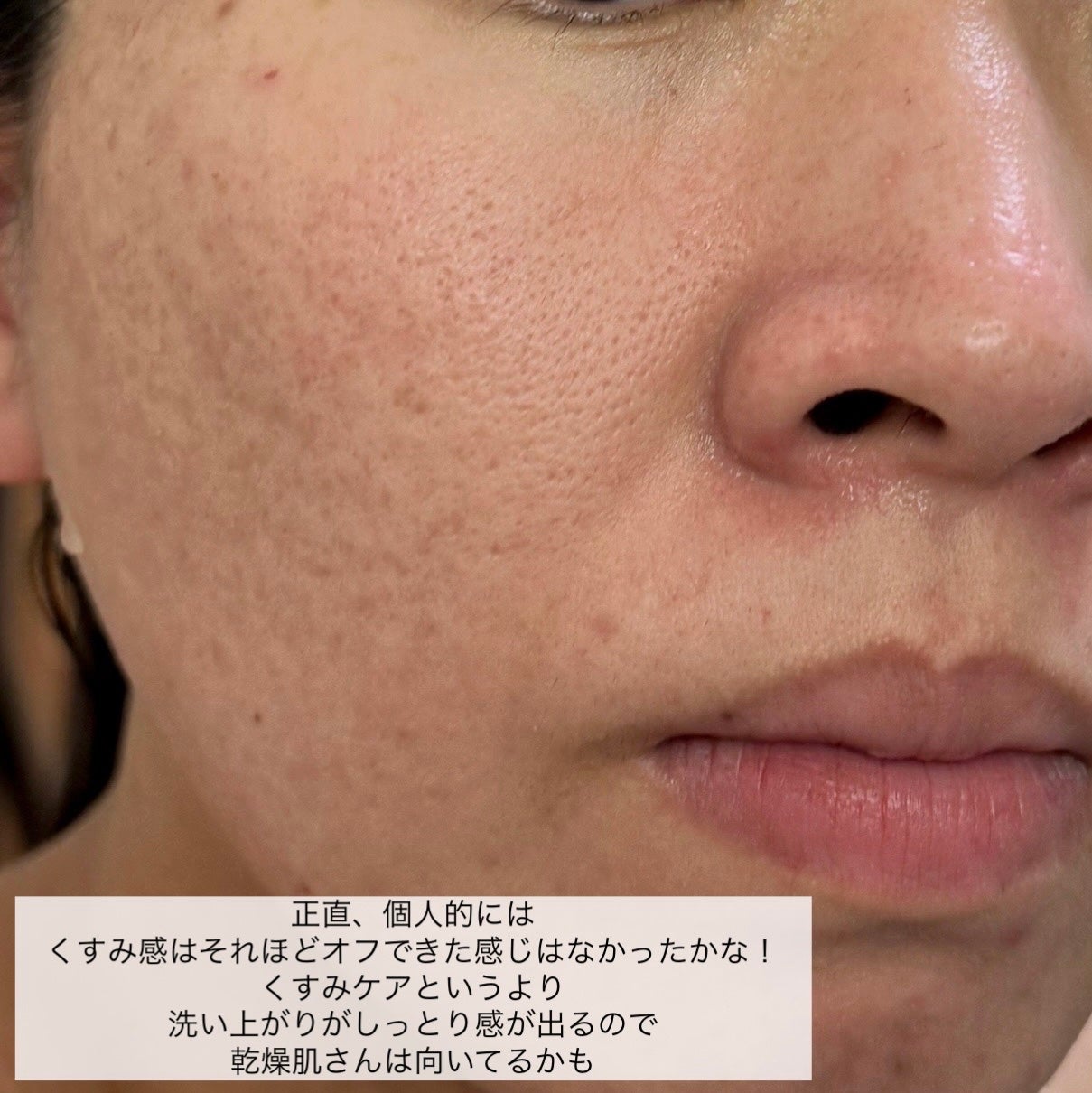 クレンジングバームB/BANILA CO/クレンジングバームを使ったクチコミ(5枚目)