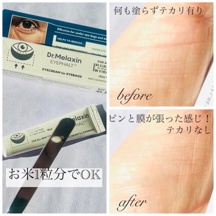 アイファルトアイバッククリーム/Dr.Melaxin/アイケア・アイクリームを使ったクチコミ(2枚目)