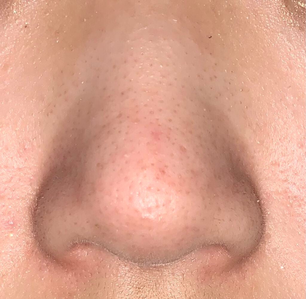 ぬりむ on LIPS 「自分の鼻の汚れがこのように目立つのですがどのようなクレンジング..」(1枚目)