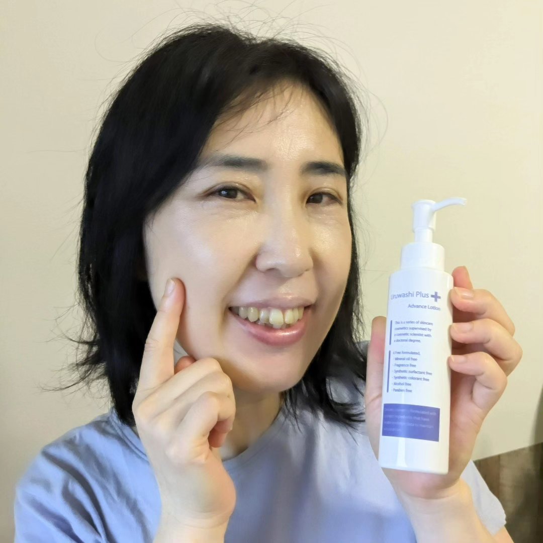ウルワシプラスADローション/ウルワシプラス/化粧水を使ったクチコミ（1枚目）