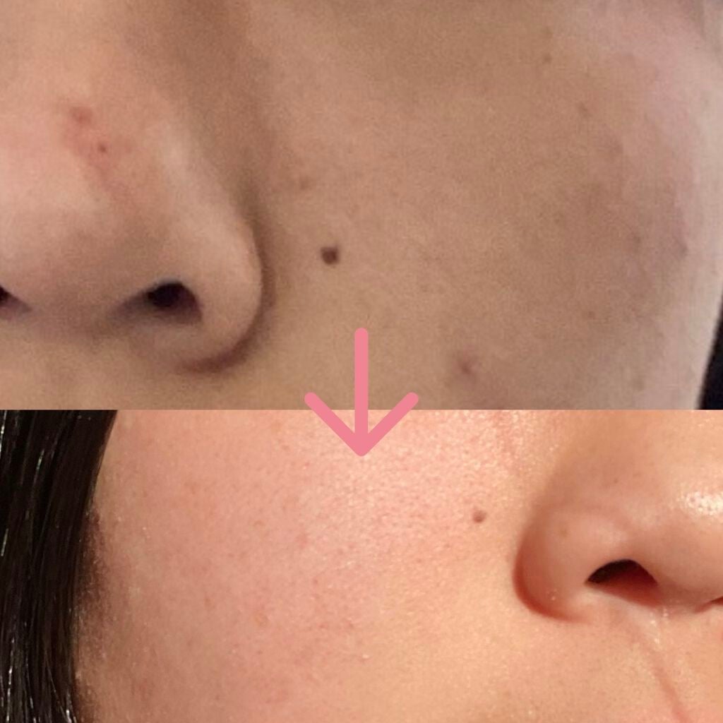 マイルド&モイスチャーアロエジェル/ネイチャーリパブリック/ボディローションを使ったクチコミ(1枚目)