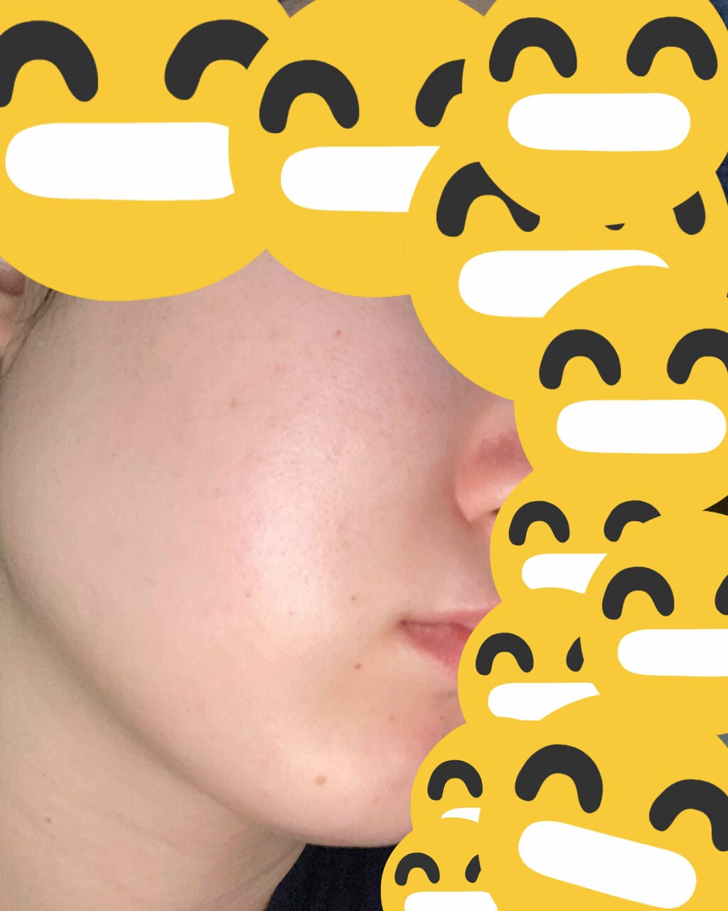 クロネコ on LIPS 「はじめまして!初投稿です🙇♀️いきなりですが私、、脂漏性皮膚..」(3枚目)