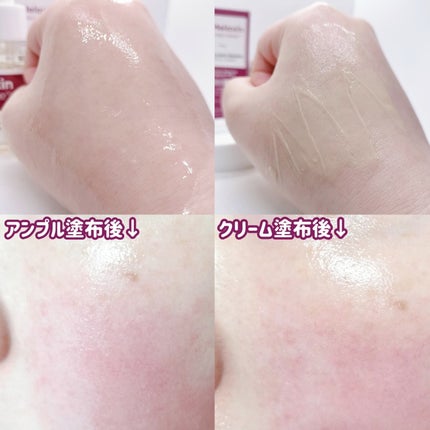 Cemenrete Calcium Intense Cream/Dr.Melaxin/フェイスクリームを使ったクチコミ(8枚目)