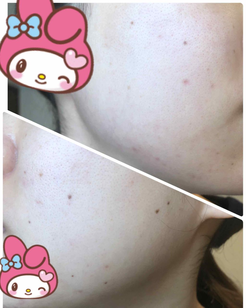 敏感肌用薬用美白美容液/無印良品/美容液を使ったクチコミ（3枚目）