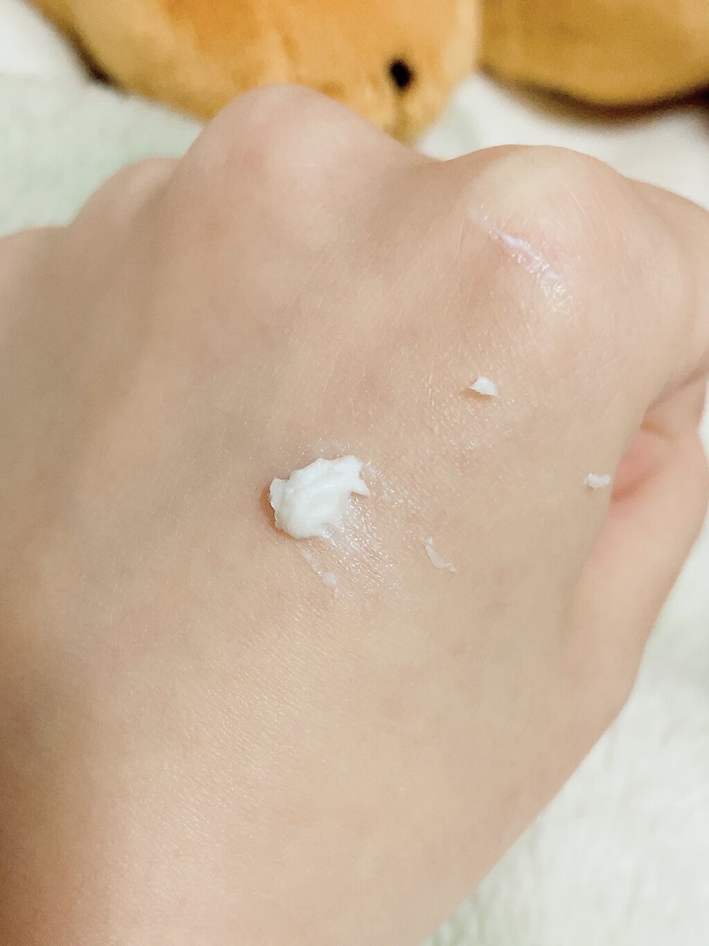 オロナインＨ軟膏 (医薬品)/オロナイン/その他を使ったクチコミ（3枚目）