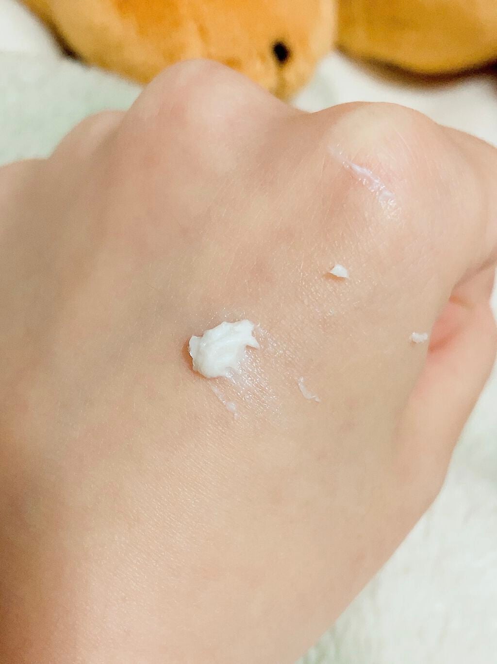 オロナインH軟膏 (医薬品)/オロナイン/その他を使ったクチコミ(3枚目)