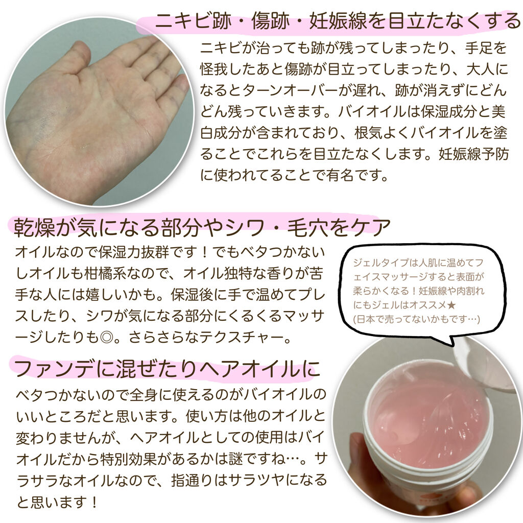 バイオイル/バイオイル/フェイスオイルを使ったクチコミ（2枚目）