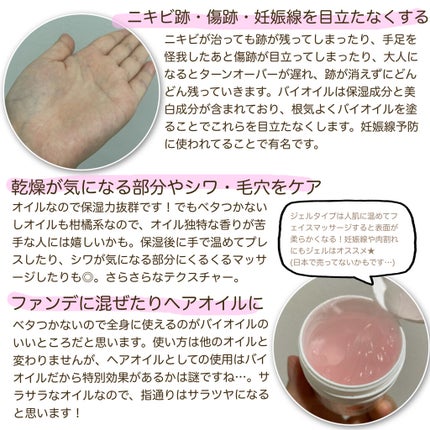 バイオイル/バイオイル/フェイスオイルを使ったクチコミ(2枚目)