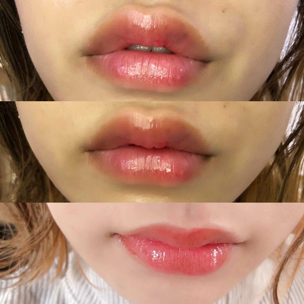 リップケアオイル/excel/リップグロスを使ったクチコミ（2枚目）