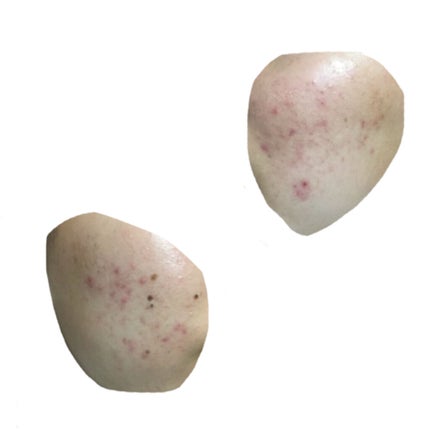 DHC ビタミンCハードカプセル/DHC/美容サプリメントを使ったクチコミ(4枚目)