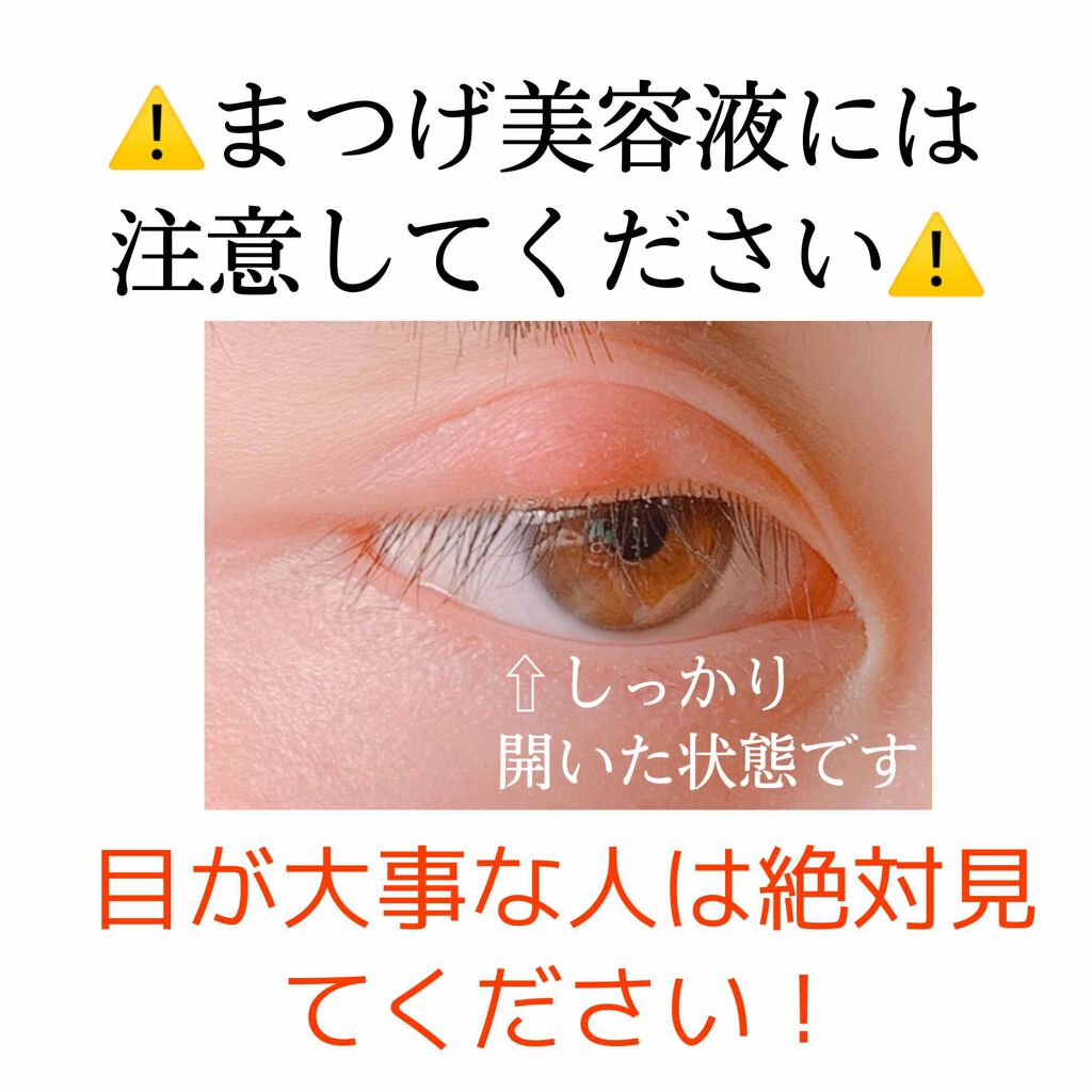 Uzu By Flowfushi アンファー スカルプd Cezanne Majolica Majorcaのまつげ美容液を使った口コミ 一番腫れたのは4ページ目です By ﾐｷ 普通肌 10代後半 Lips