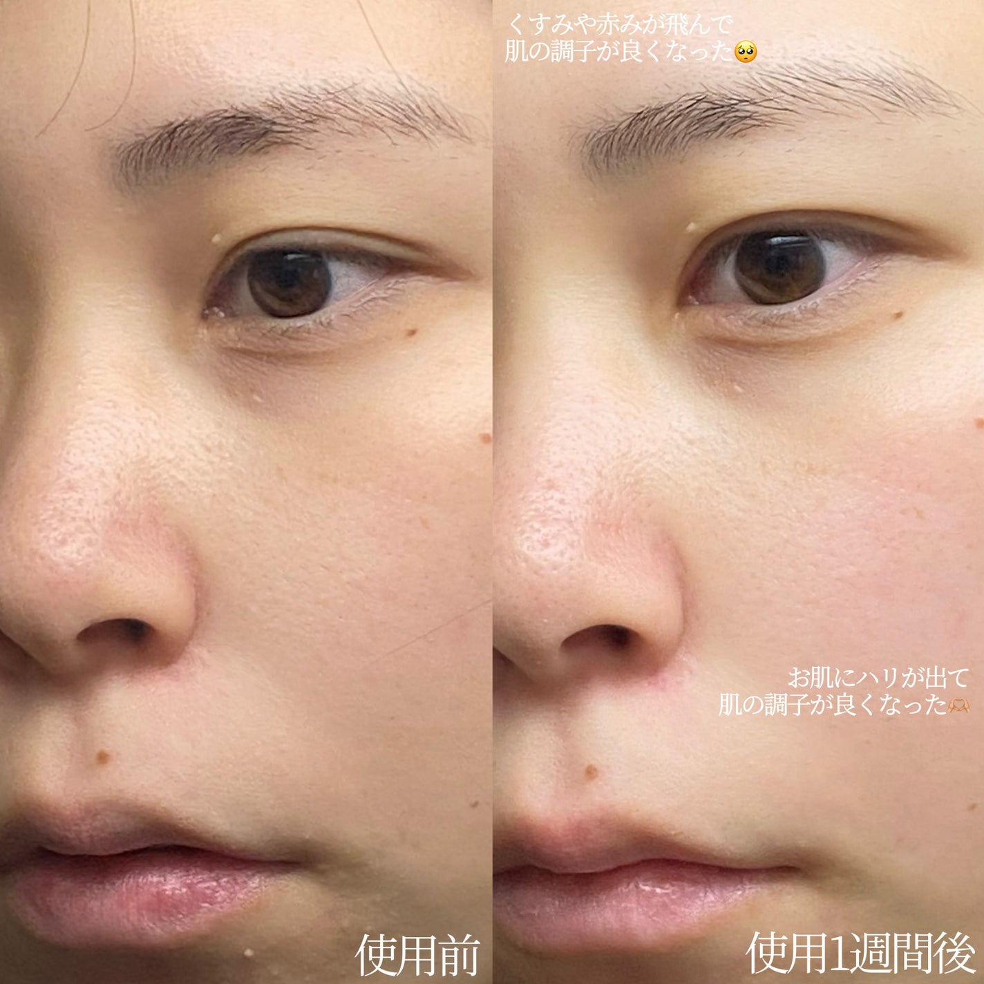 サミュ PHセンシティブクリーム/SAM'U/フェイスクリームを使ったクチコミ(2枚目)