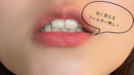 シュミテクト トゥルーホワイト/シュミテクト/歯磨き粉を使ったクチコミ(2枚目)