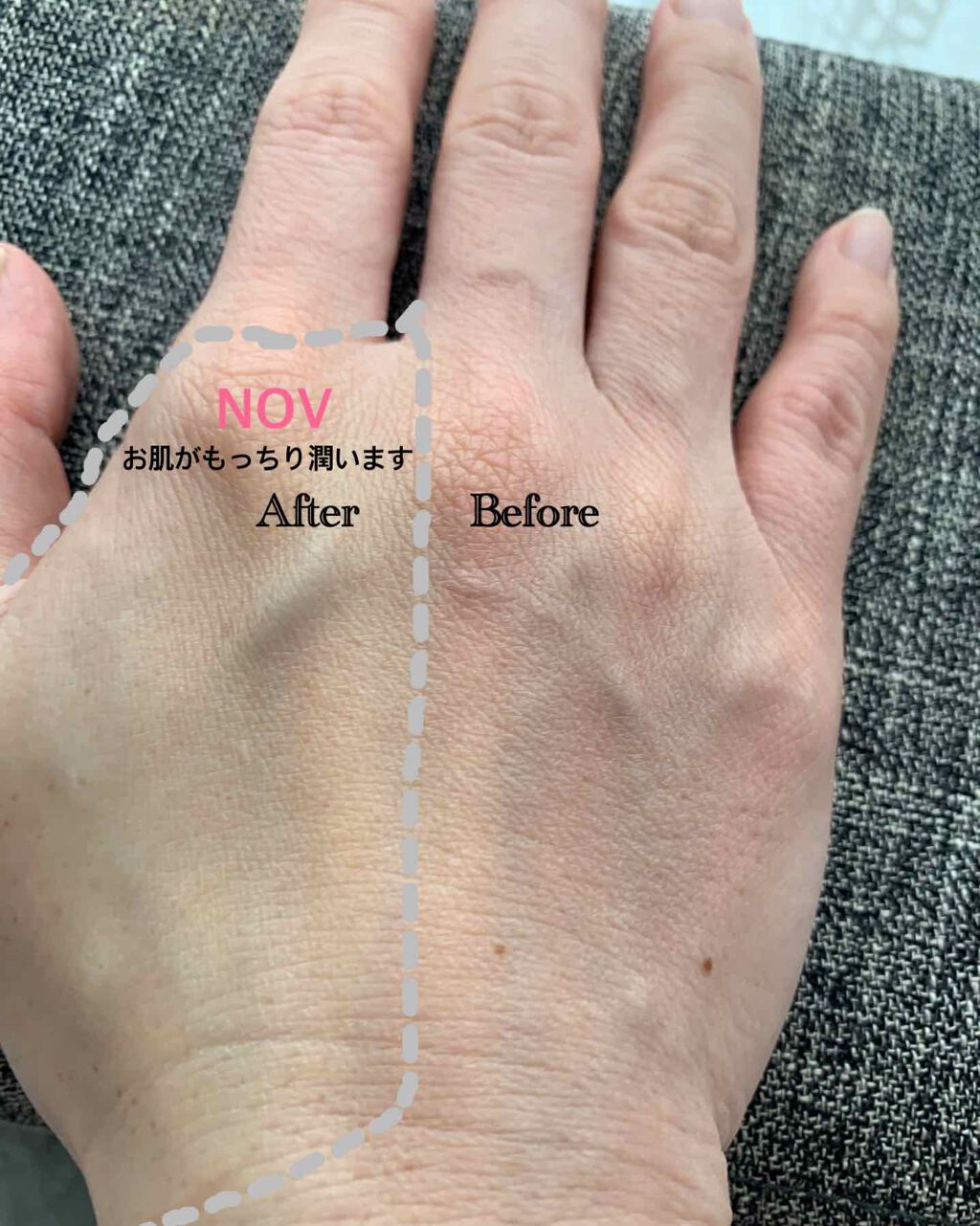 Ⅲ トライアルセット/NOV/トライアルキットを使ったクチコミ（2枚目）